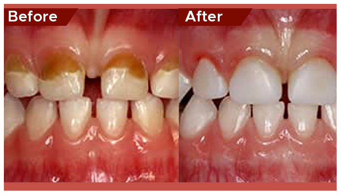 pediatric dentist in Abu Dhabi